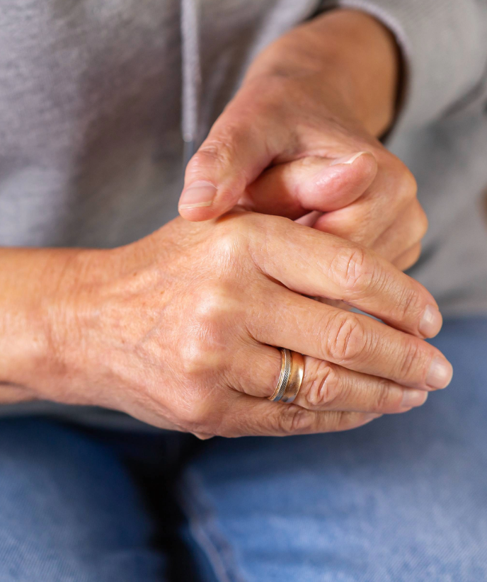 Thumb Osteoarthritis Early