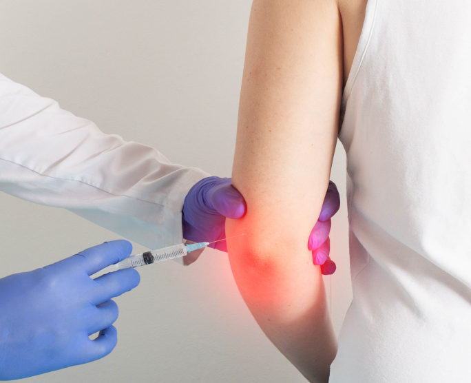 Nerve Entrapment Release