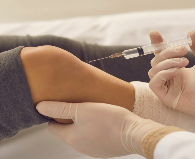 Prolotherapy Injections